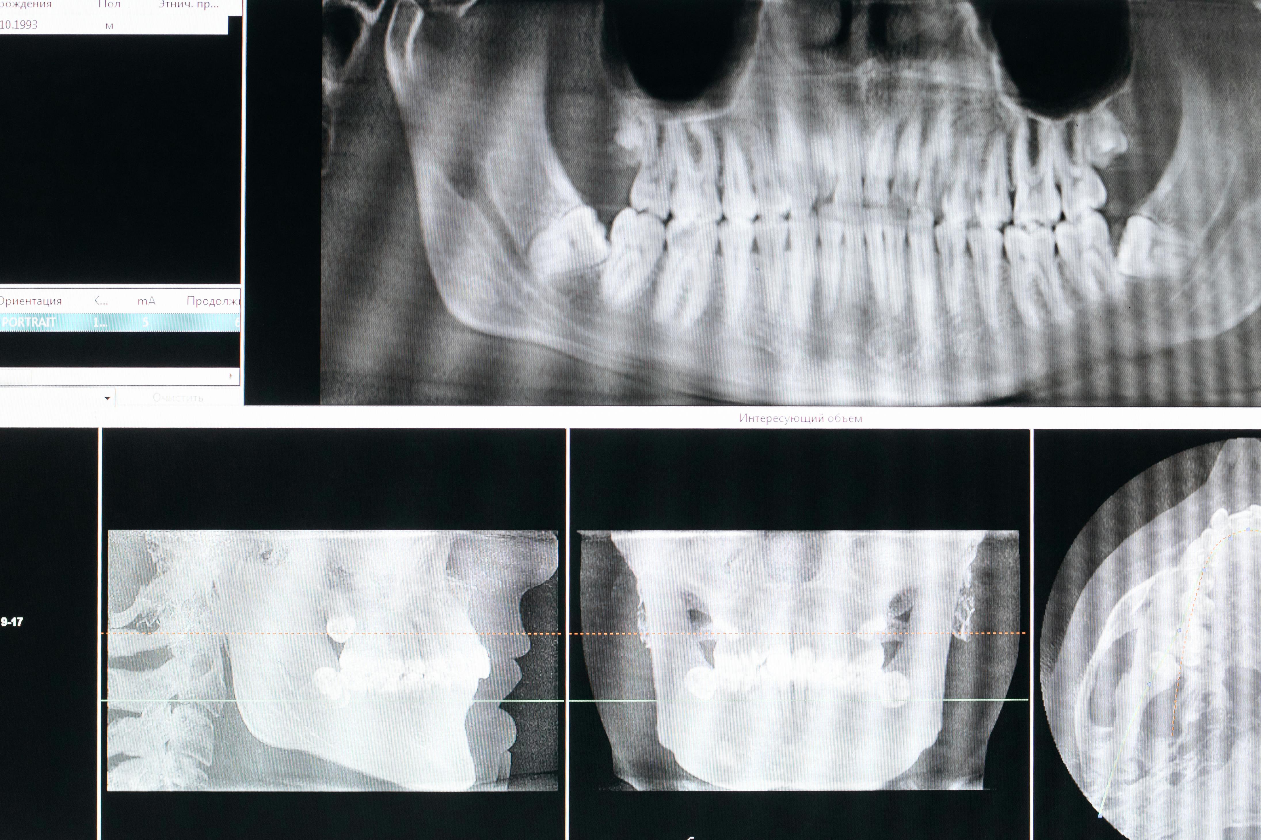 Radiology Medical Imaging